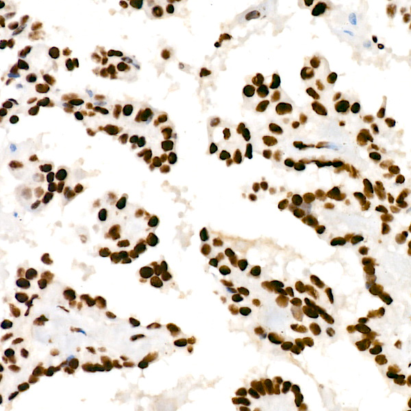 HNRNPD Rabbit monoclonal antibody