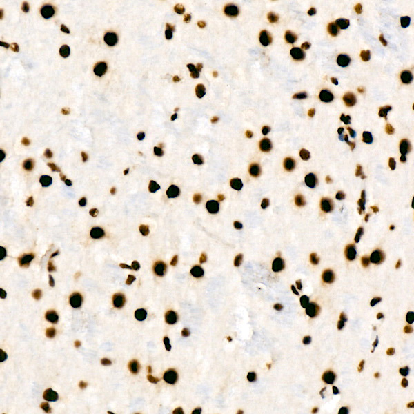 HNRNPD Rabbit monoclonal antibody