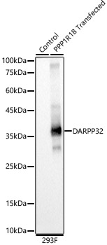 DARPP32 Rabbit monoclonal antibody