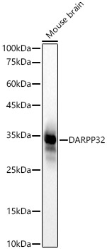 DARPP32 Rabbit monoclonal antibody