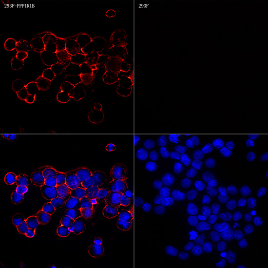 DARPP32 Rabbit monoclonal antibody