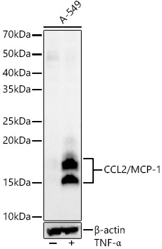 CCL2/MCP-1 Rabbit mAb