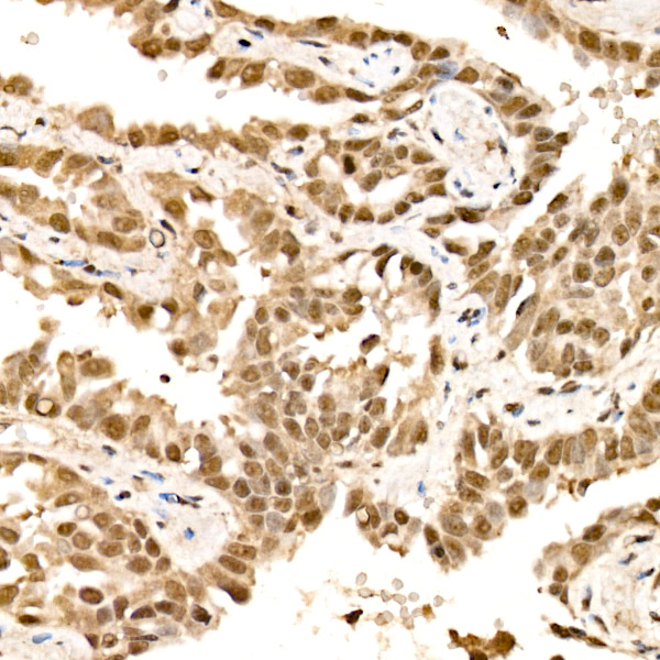 VDR Rabbit monoclonal antibody