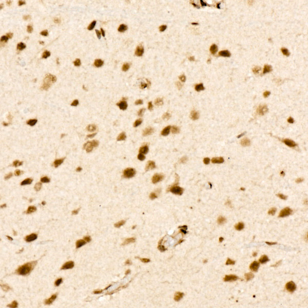 VDR Rabbit monoclonal antibody
