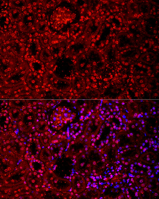 VDR Rabbit monoclonal antibody