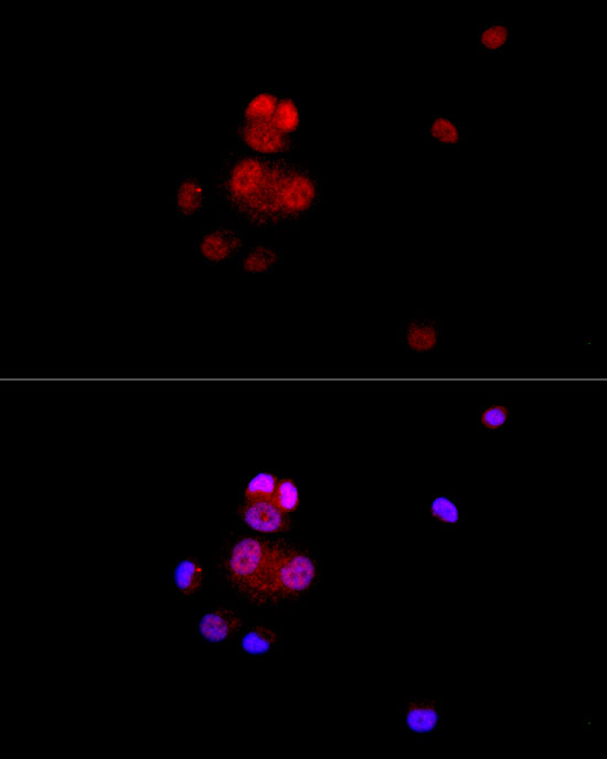 VDR Rabbit monoclonal antibody