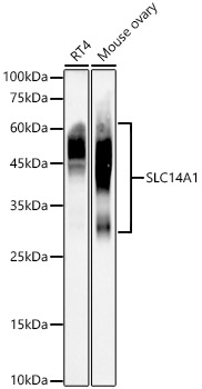 SLC14A1 Rabbit monoclonal antibody