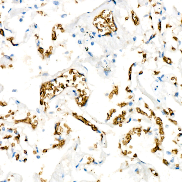 SLC14A1 Rabbit monoclonal antibody