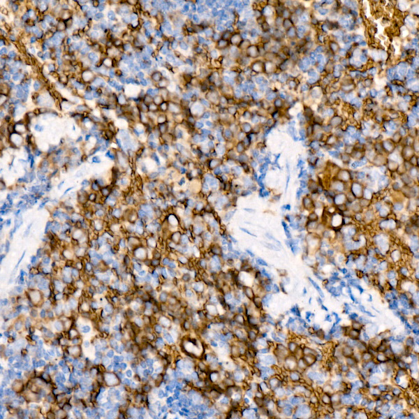 SLC14A1 Rabbit monoclonal antibody