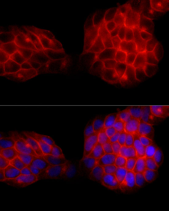 SLC14A1 Rabbit monoclonal antibody