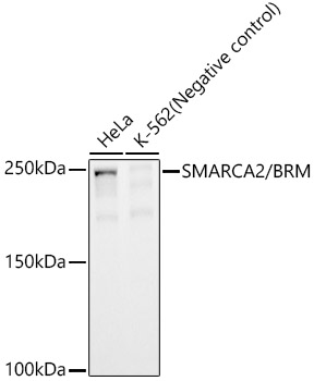 SMARCA2 / BRM Rabbit monoclonal antibody