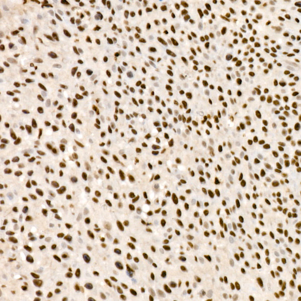 SMARCA2 / BRM Rabbit monoclonal antibody