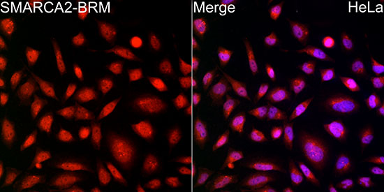 SMARCA2 / BRM Rabbit monoclonal antibody