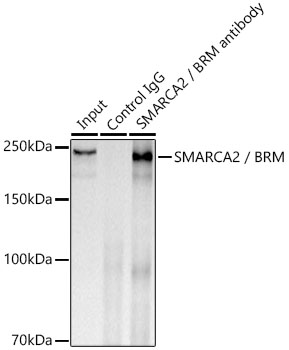 SMARCA2 / BRM Rabbit monoclonal antibody
