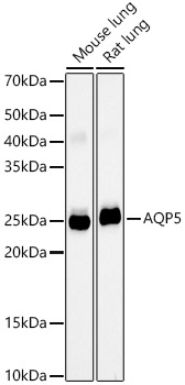 AQP5 Rabbit monoclonal antibody