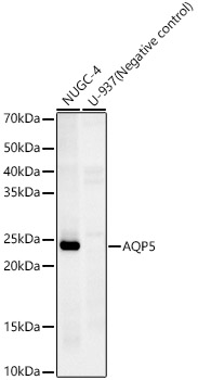 AQP5 Rabbit monoclonal antibody