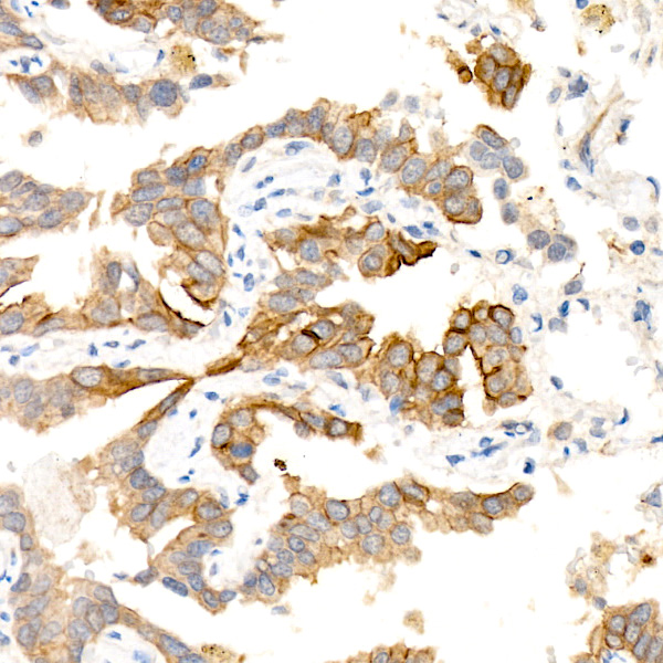 AQP5 Rabbit monoclonal antibody