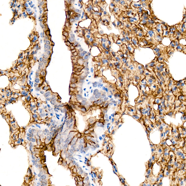 AQP5 Rabbit monoclonal antibody