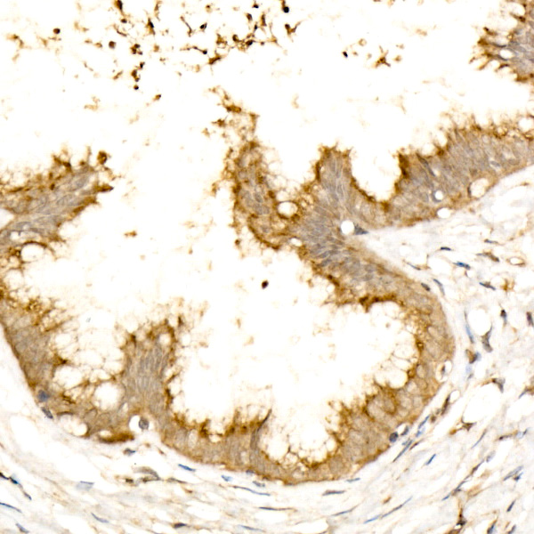 GOLGA4 Rabbit monoclonal antibody