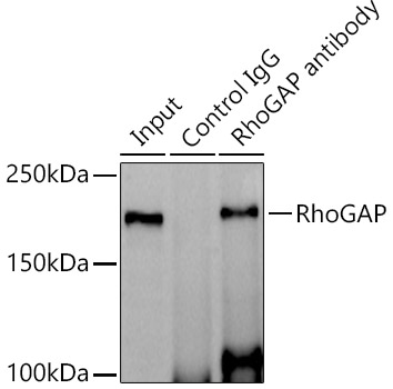 RhoGAP Rabbit monoclonal antibody