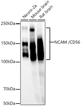 NCAM /CD56 Rabbit monoclonal antibody