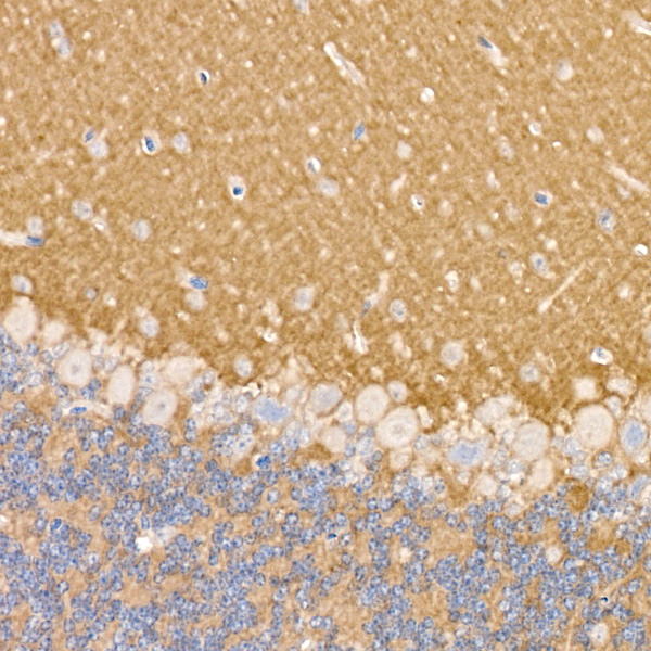 NCAM /CD56 Rabbit monoclonal antibody