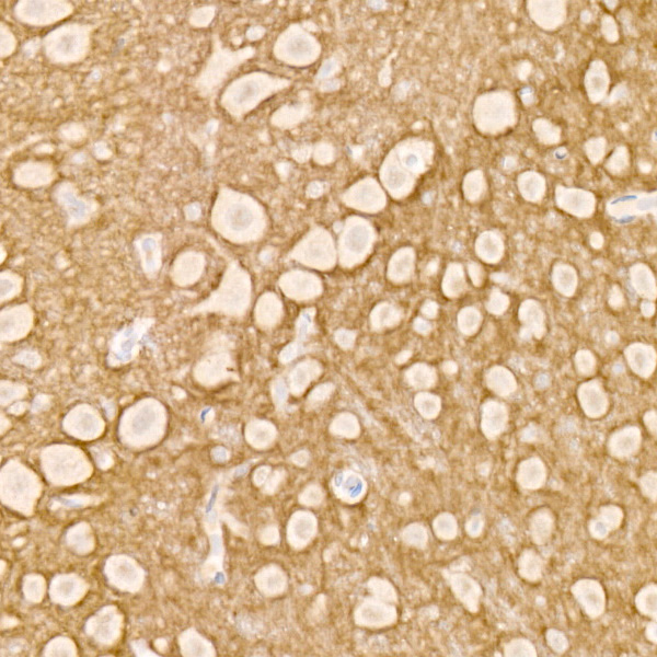 NCAM /CD56 Rabbit monoclonal antibody
