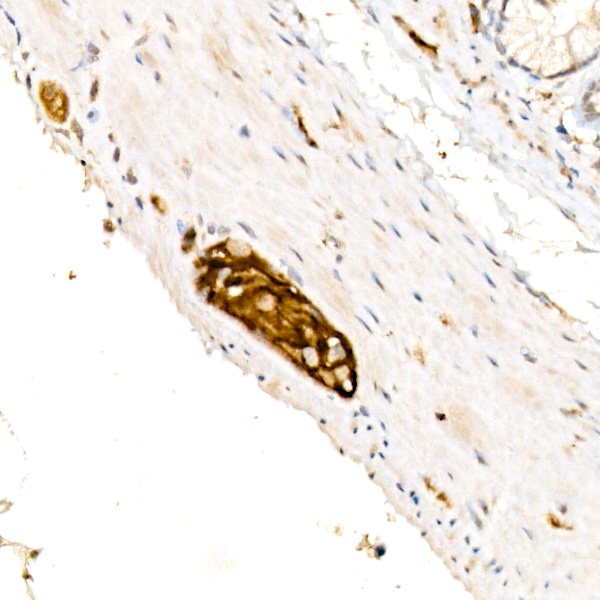 NCAM /CD56 Rabbit monoclonal antibody