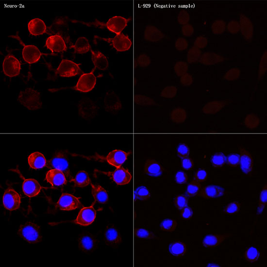 NCAM /CD56 Rabbit monoclonal antibody