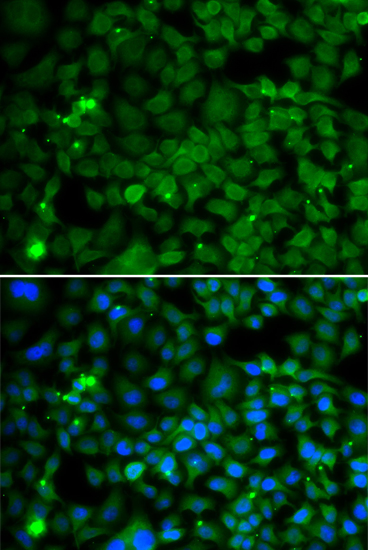 SMYD4 Rabbit polyclonal antibody