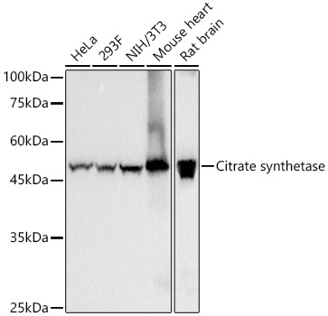 Citrate synthetase Rabbit monoclonal antibody