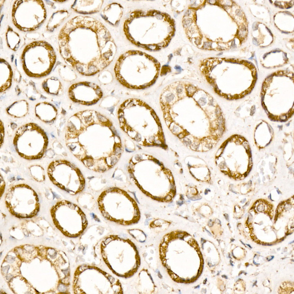 Citrate synthetase Rabbit monoclonal antibody