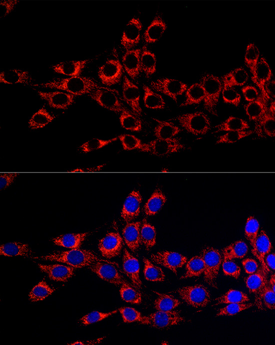 Citrate synthetase Rabbit monoclonal antibody