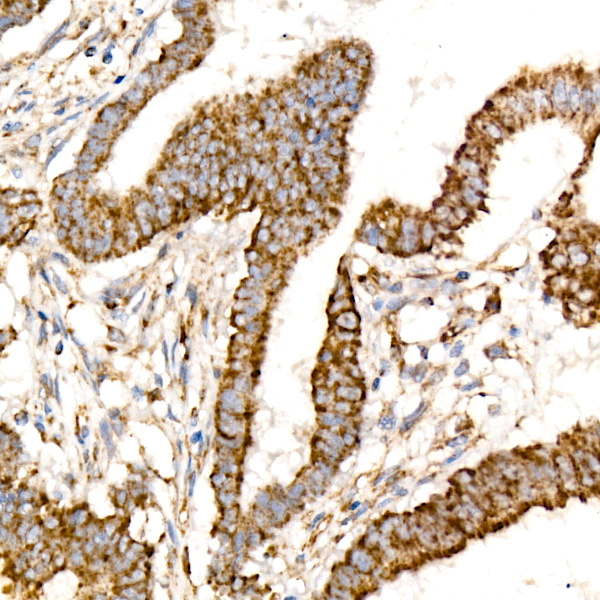 Citrate synthetase Rabbit monoclonal antibody