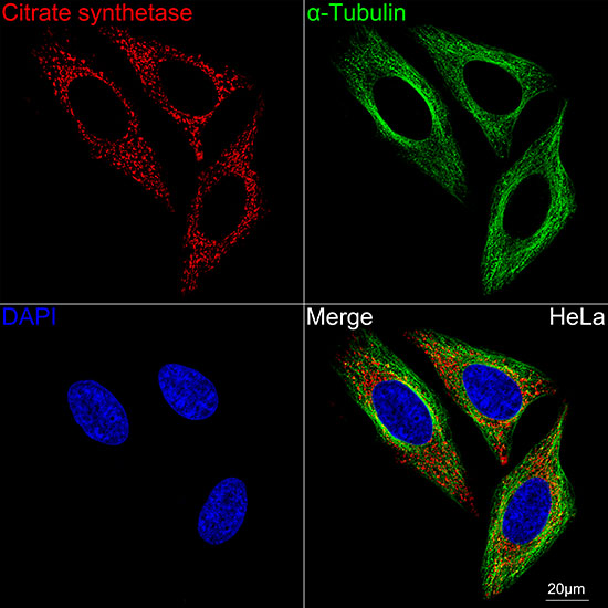 Citrate synthetase Rabbit monoclonal antibody