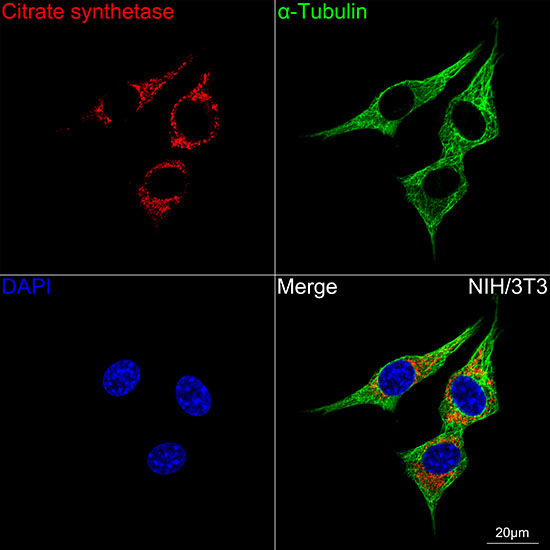 Citrate synthetase Rabbit monoclonal antibody