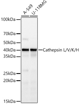 Cathepsin L Rabbit monoclonal antibody
