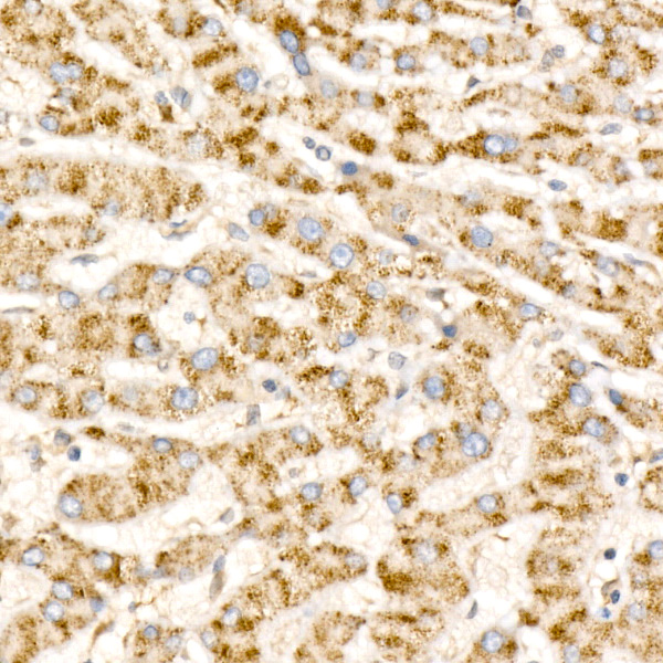 Cathepsin L Rabbit monoclonal antibody