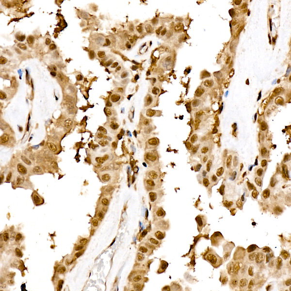 Proteasome 20S LMP7/PSMB8 Rabbit monoclonal antibody