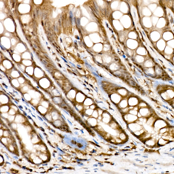 Proteasome 20S LMP7/PSMB8 Rabbit monoclonal antibody