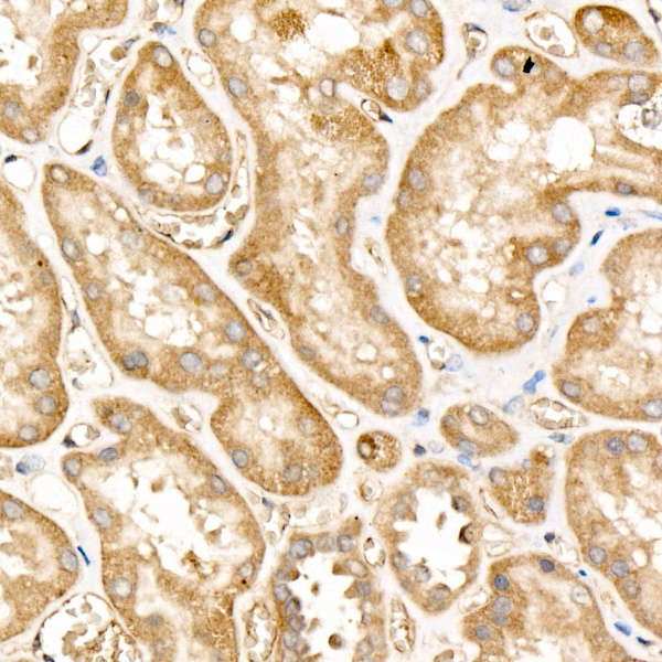 [KO Validated] FAM38A/PIEZO1 Rabbit monoclonal antibody