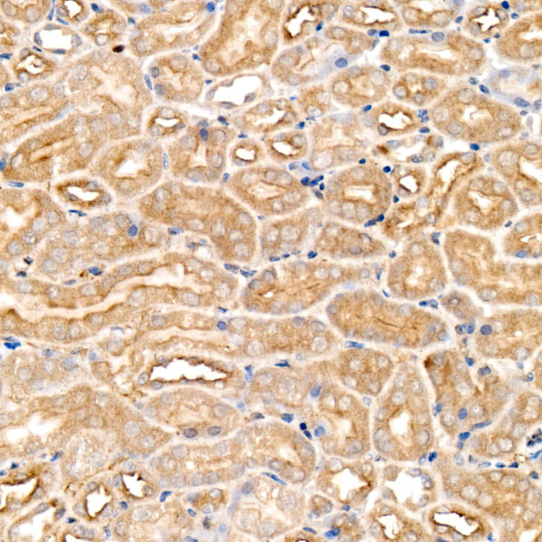 [KO Validated] FAM38A/PIEZO1 Rabbit monoclonal antibody