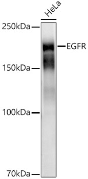 [KD Validated] EGFR Rabbit monoclonal antibody