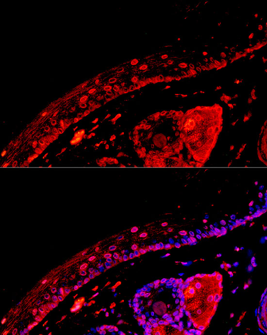[KD Validated] EGFR Rabbit monoclonal antibody