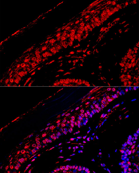 [KD Validated] EGFR Rabbit monoclonal antibody