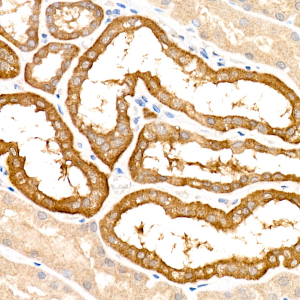 [KO Validated] KRAS Rabbit monoclonal antibody