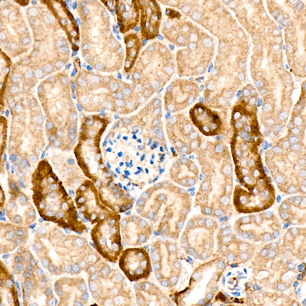 [KO Validated] KRAS Rabbit monoclonal antibody