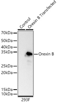 Orexin B Rabbit monoclonal antibody