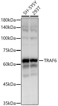 TRAF6 Rabbit monoclonal antibody