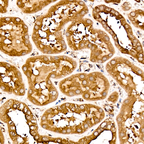 TRAF6 Rabbit monoclonal antibody